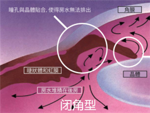 治疗青光眼医院排名_青光眼医院处方单(3)